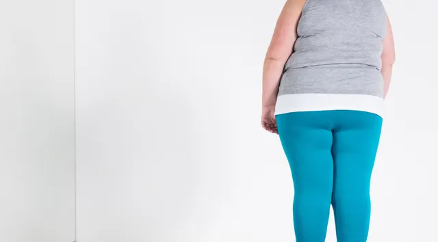 overgewicht, obesitas bij kinderen, moet medicatie voor kinderen met overgewicht vergoed worden door de verzekering?.